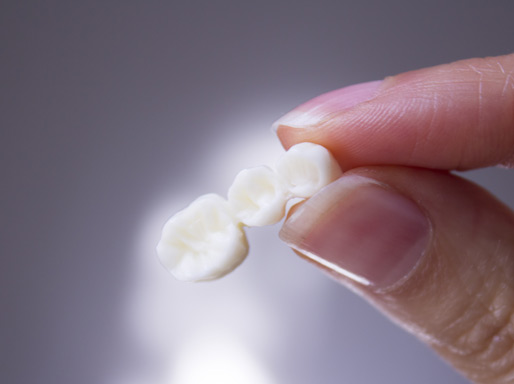 Taralake Dental Calgary - Crowns & Bridges Taralake Dental Calgary - Crowns & Bridges